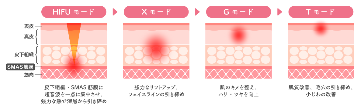 トリプルモードの仕組み