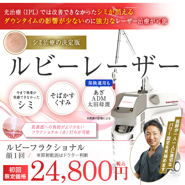 ルビーレーザー