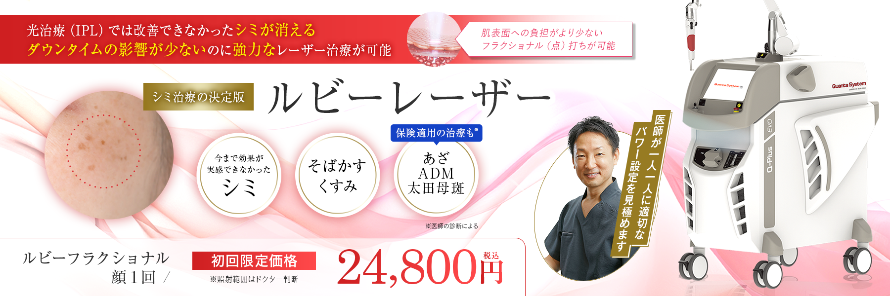 ルビーレーザー